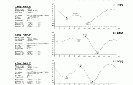 gabinet okulistyczny - wyniki badań elektrofizjologicznych 5