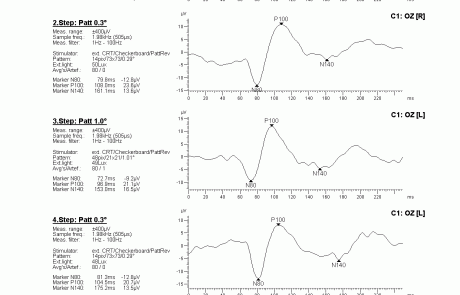 gabinet okulistyczny - wyniki badań elektrofizjologicznych 9