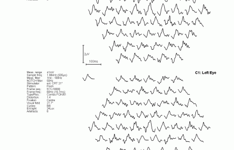 gabinet okulistyczny - wyniki badań elektrofizjologicznych 10