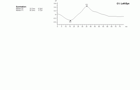 gabinet okulistyczny - wyniki badań elektrofizjologicznych 11